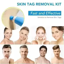 Adult Skin Tag Mole Wart Remover
